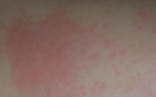 一品红有没有毒，全株都带有一定的毒性