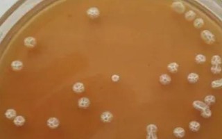 枯草芽孢杆菌的适宜温度，25-37℃为佳