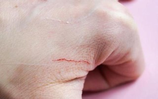 怎么防止被猫抓伤,发情期尽可能减少与猫咪的接触