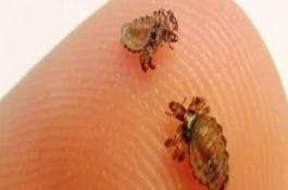 虱子怎么去除，一天产下7-8枚卵